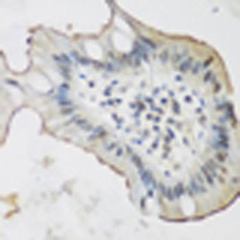ALOX15 Antibody