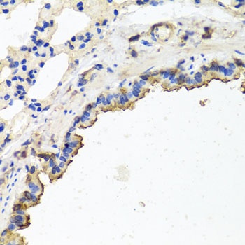 TUBB8 Antibody