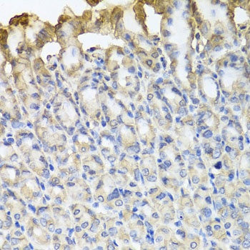 TUBB8 Antibody