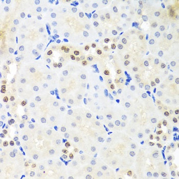 DDX39A Antibody