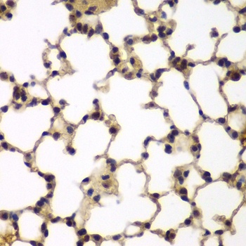 E2F6 Antibody