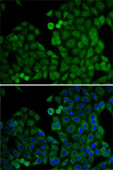 E2F6 Antibody