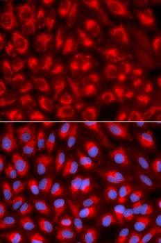 TFAM Antibody