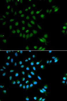 XRCC2 Antibody