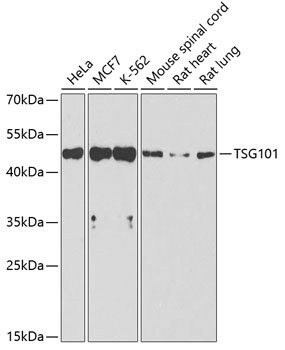 TSG101 Antibody