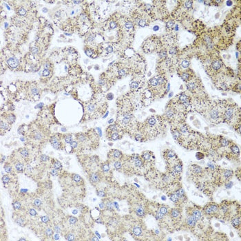 TSG101 Antibody