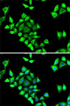 SERPINH1 Antibody