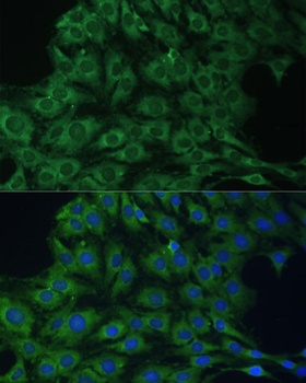 YTHDF1 Antibody