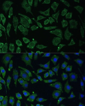 YTHDF1 Antibody