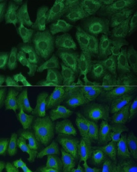 YTHDF1 Antibody