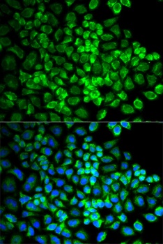 GRIA3 Antibody