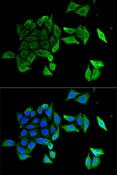 EFNB2 Antibody