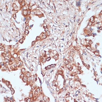 ACAT1 Antibody