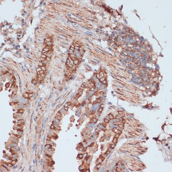 ACAT1 Antibody