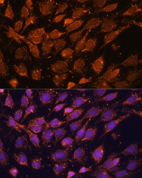 ACAT1 Antibody