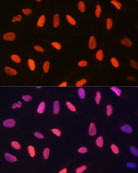 ACAT1 Antibody