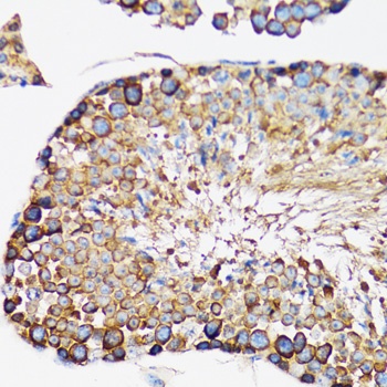 IRAK4 Antibody