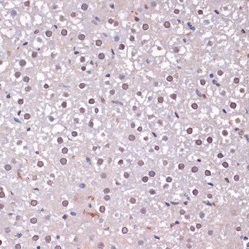 CDKN2A Antibody