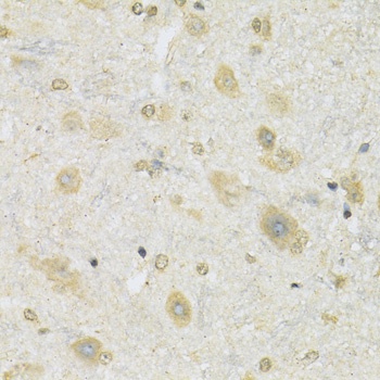 SLC2A13 Antibody