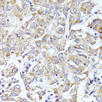 EIF3L Antibody