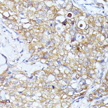 EIF3L Antibody