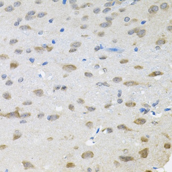TRPC1 Antibody