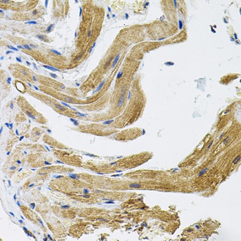 TRPC1 Antibody