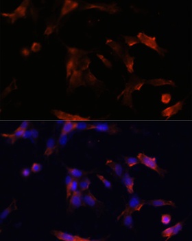 AQP5 Antibody