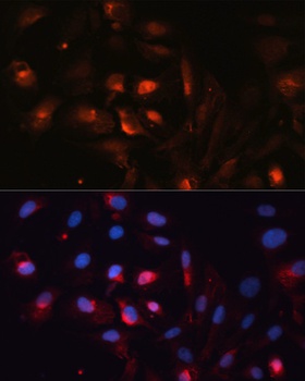 AQP5 Antibody