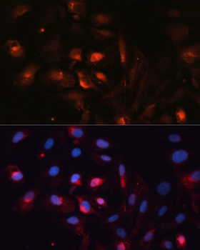 AQP5 Antibody