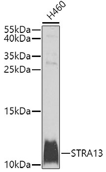 STRA13 Antibody