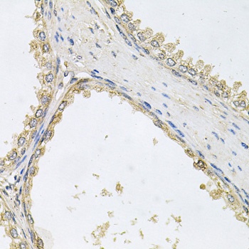 POMGNT1 Antibody