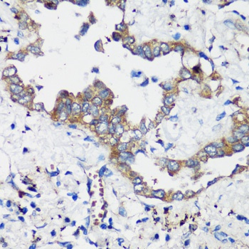 ELP3 Antibody