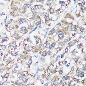 ELP3 Antibody