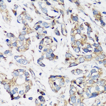 ELP3 Antibody