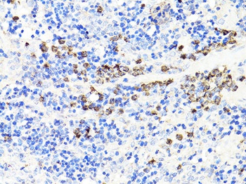 S100A9 Antibody