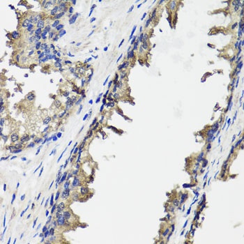 OTC Antibody