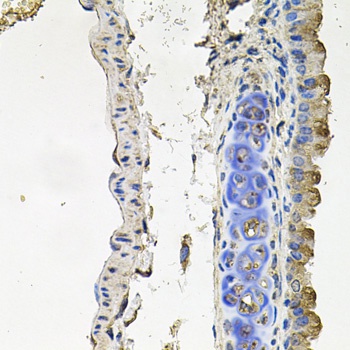 NDUFA6 Antibody