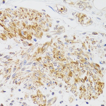 MYO5A Antibody