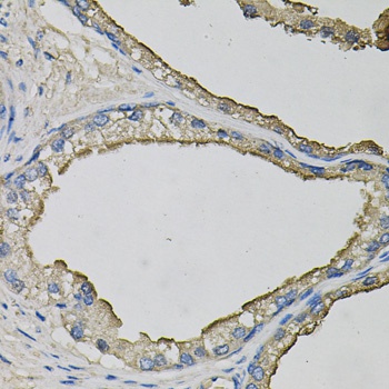 LCN1 Antibody