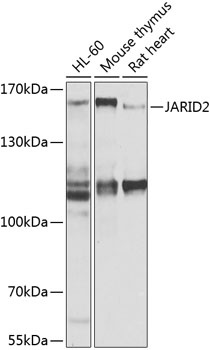 JARID2 Antibody