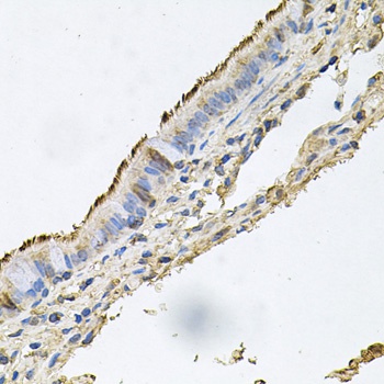DSG1 Antibody