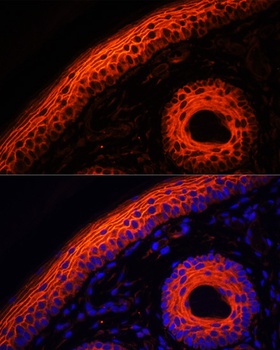 DSG1 Antibody