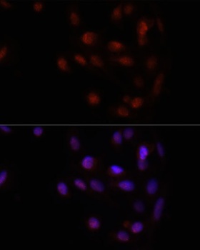 HOXA2 Antibody