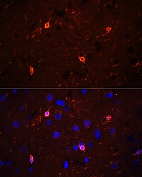 CORO1A Antibody