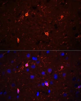 CORO1A Antibody