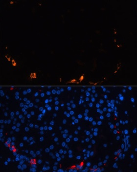 SST Antibody