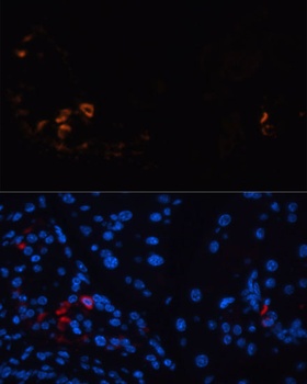 SST Antibody