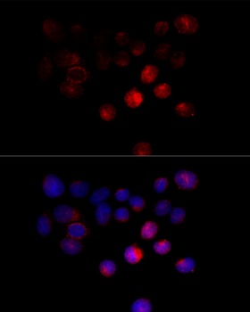 TOM1 Antibody