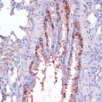 RPL22 Antibody